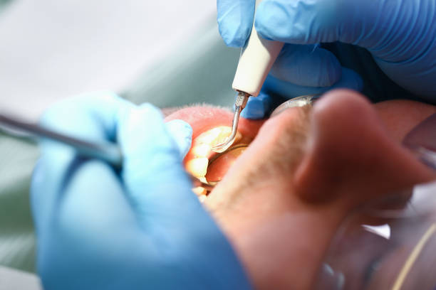 Professional Emergency Dental Service in WI